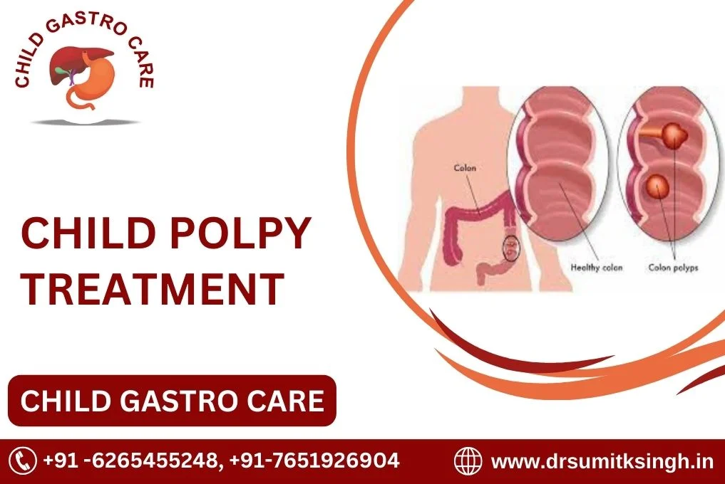 Best Treatment for Child Polyps in Indore