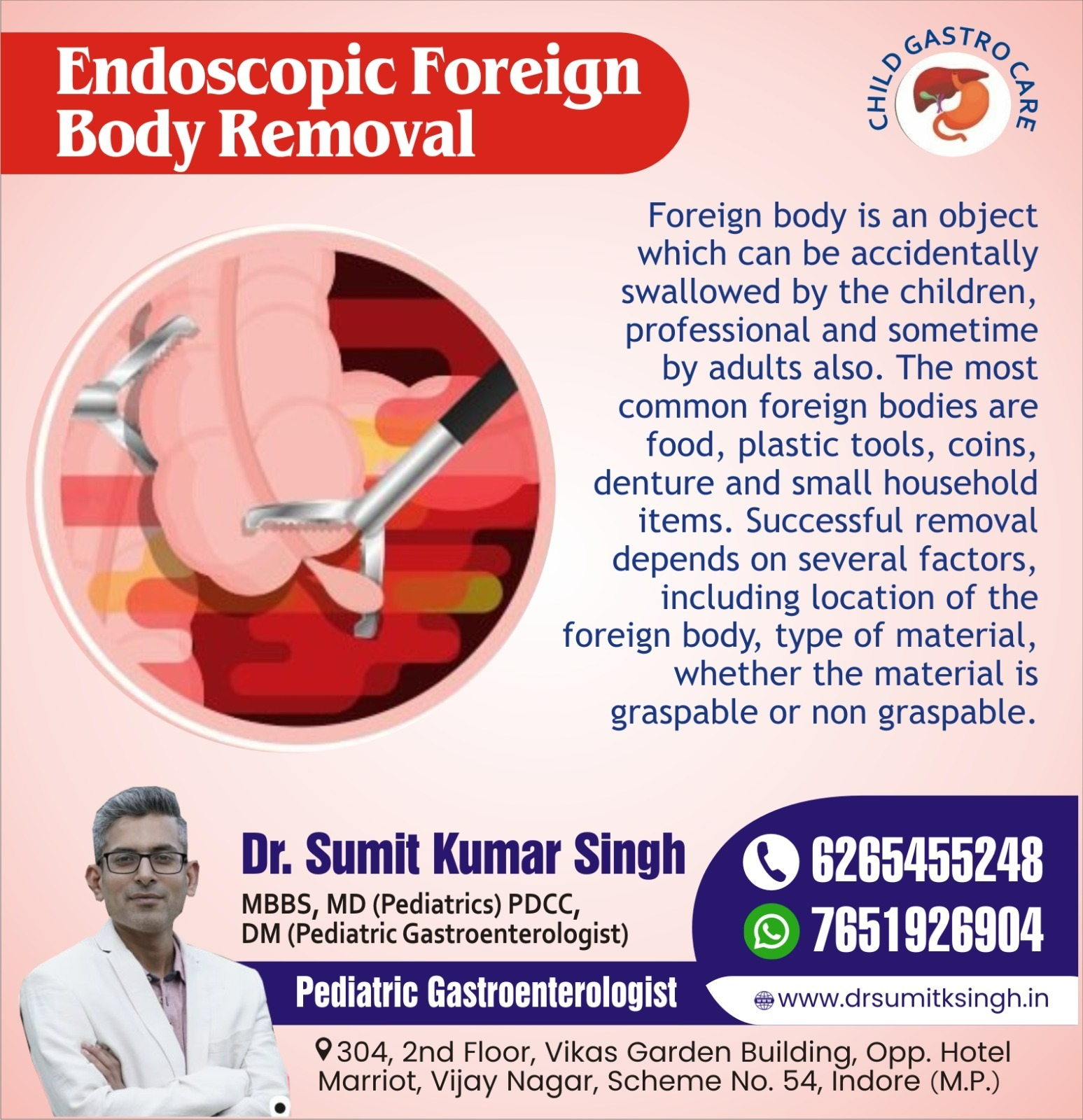 Endoscopic Foreign Body Removal Treatment In Indore